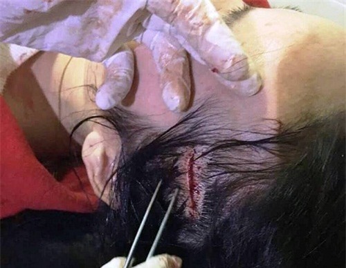 tin tuc moi nhat vu co giao to chuc 'bat coc', danh nguoi o ha tinh - 1