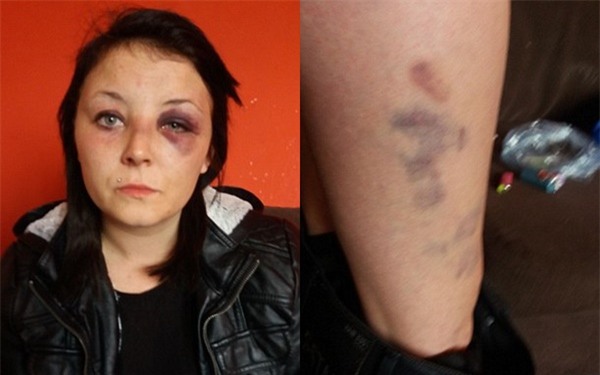 Kỷ niệm 1 năm hẹn hò, thanh niên uống gần 9 lít bia rồi đánh đập, kéo lê bạn gái trên đường - Ảnh 2.