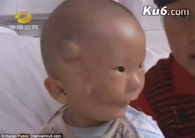 Cậu bé hai mặt lúc nào cũng như đang đeo mặt nạ từ lúc mới sinh - Ảnh 3.