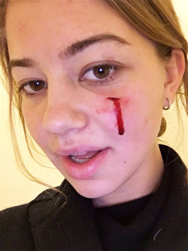 Chó cưng nhà Tổng thống Obama cắn người tại Nhà Trắng - Ảnh 3.