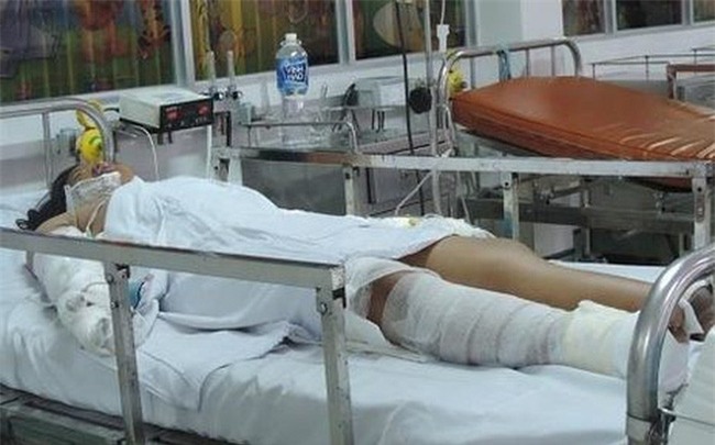 Níu giữ tình cảm bất thành, nam thanh niên tưới xăng đốt bạn gái ở Sài Gòn - Ảnh 1.