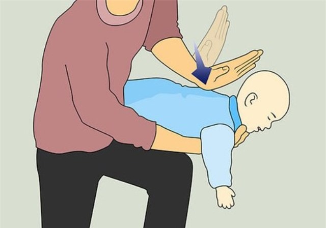 Khi trẻ dưới 3 tuổi bị hóc dị vật cha mẹ cần sơ cứu đúng cách. Tranh minh họa