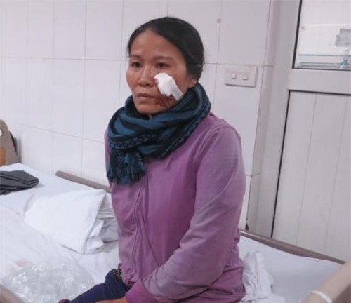 lat xe o nghe an 14 nguoi nhap vien: hanh khach ke lai giay phut sinh tu - 2