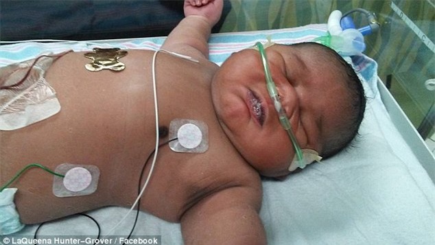 Tưởng sinh đôi vì bụng bầu quá lớn, không ngờ bà mẹ lại sinh ra con như thế này - Ảnh 1.