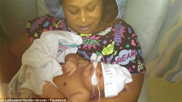 Tưởng sinh đôi vì bụng bầu quá lớn, không ngờ bà mẹ lại sinh ra con như thế này - Ảnh 2.