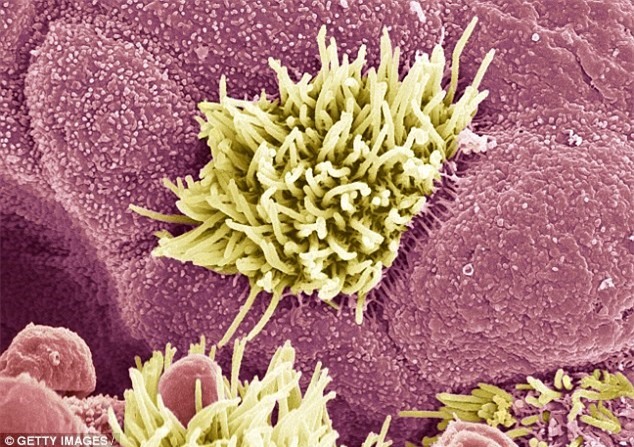 Màu sắc của đờm cảnh báo bệnh nguy hiểm - Ảnh 2.