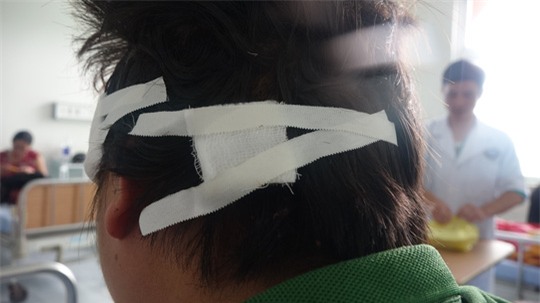 Cho người lạ đi nhờ xe, bị tấn công suýt chết - 1