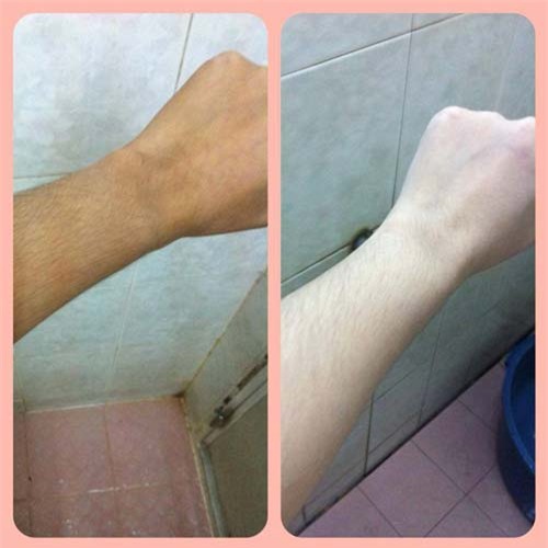 1 lon bia 3 cach lam trang da va tri mun cho lan da trang su nhu ngoc trinh - 7