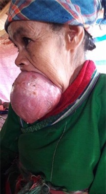 Ba cu mang cai luoi khong lo chua tung thay o Viet Nam