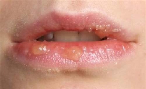 dung son ma khong biet nhung meo nay bao sao son len khong dung mau lai nhanh troi - 1