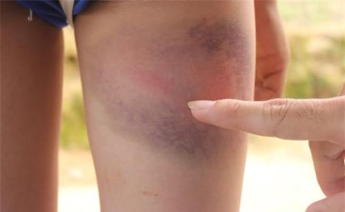 6-hoc-sinh-bi-giao-vien-danh-bam-tim