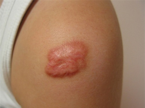 Phát hiện 9 dấu hiệu nhỏ này trên cơ thể, hãy cảnh giác với những căn bệnh nguy hiểm - Ảnh 3.