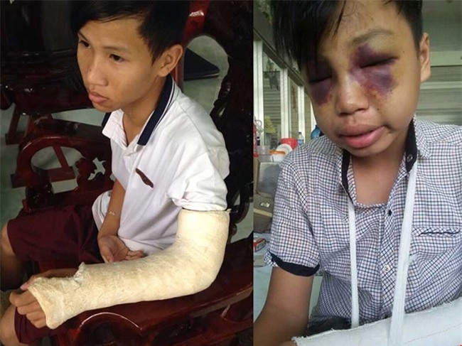 dieu tra vu cong an xa bi to dung gay danh khien hoc sinh tu vong hinh anh 1