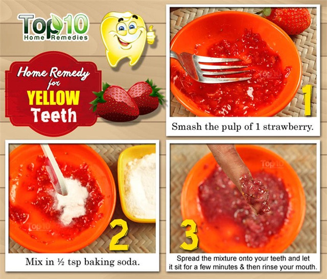 Khỏi đến nha sĩ, chỉ vài nghìn đồng và 5 phút là bạn có thể lấy sạch cao răng để đón Tết - Ảnh 1.