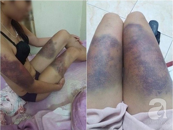 Nỗi đau của người mẹ không dám về quê ăn Tết với 2 con nhỏ vì sợ bị bạn trai cũ đi theo trả thù - Ảnh 2.