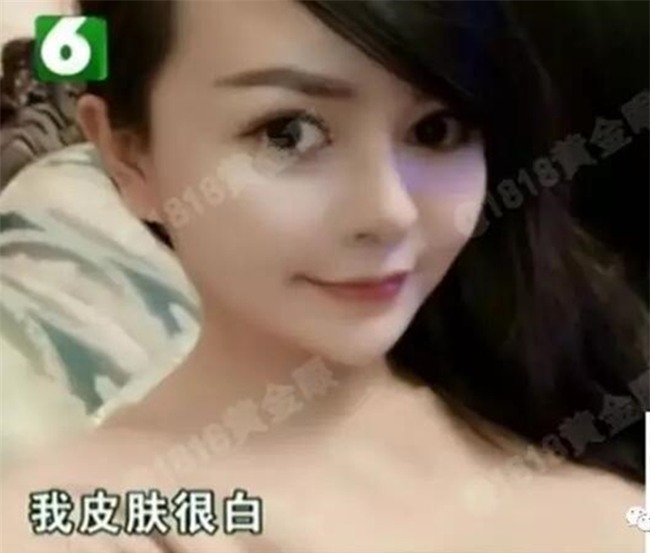 Mất gần 200 triệu phẫu thuật thẩm mỹ, ai dè bị cô bạn thân 6 năm hủy hoại nhan sắc chỉ vì một câu nói - Ảnh 2.