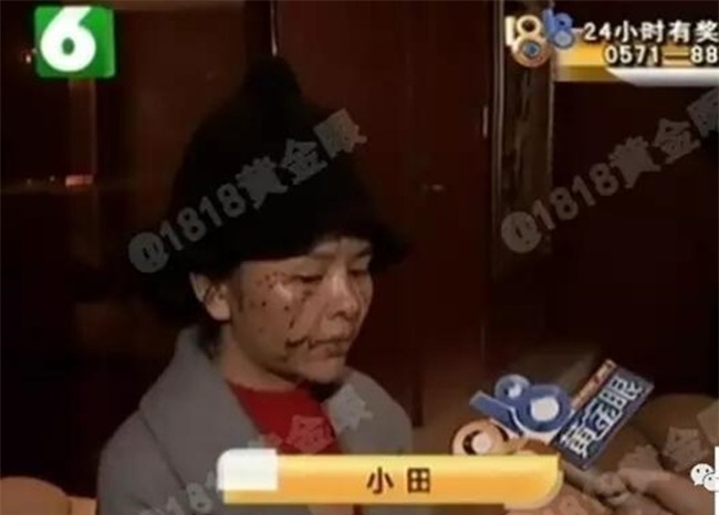 Mất gần 200 triệu phẫu thuật thẩm mỹ, ai dè bị cô bạn thân 6 năm hủy hoại nhan sắc chỉ vì một câu nói - Ảnh 4.