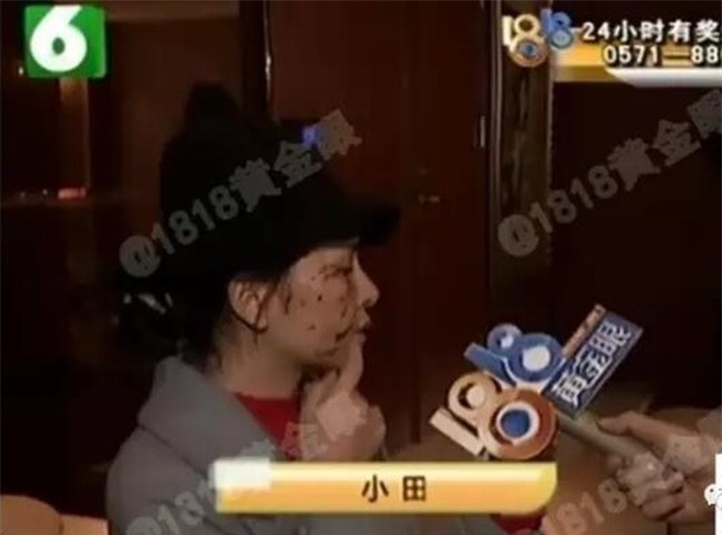 Mất gần 200 triệu phẫu thuật thẩm mỹ, ai dè bị cô bạn thân 6 năm hủy hoại nhan sắc chỉ vì một câu nói - Ảnh 5.