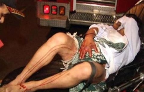 Dang nam ngu, bi ban nhau cat dut ‘cua quy’ hinh anh