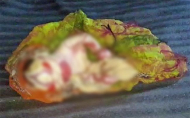 Em bé bị bố mẹ ruồng bỏ vì khuôn mặt dị dạng và làn da bong tróc như sinh vật ngoài hành tinh - Ảnh 2.