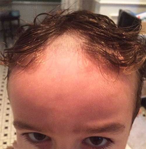 cuoi te ghe khi lu tre nghich ngom tu cat toc minh - 2