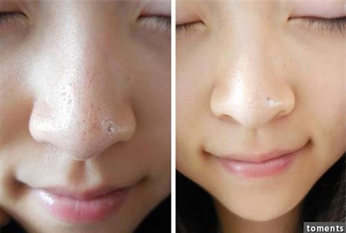 2 cach se khit lo chan long cho lan da vua min mang vua sang bong - 6