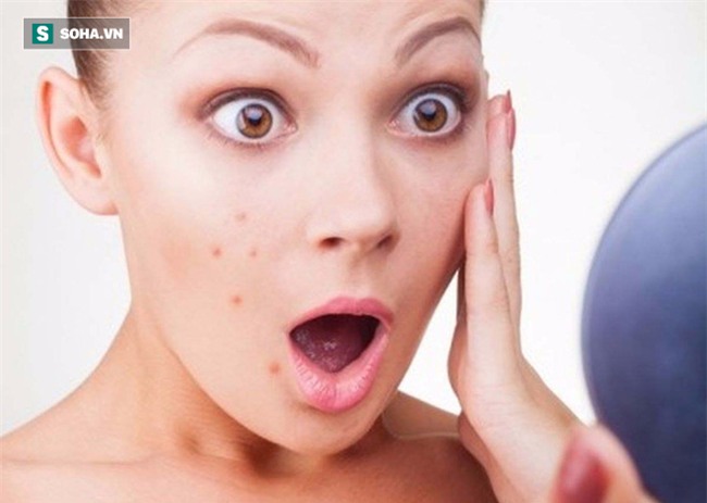 Có 1 trong 5 dấu hiệu này, hãy kiểm tra gan ngay trước khi quá muộn - Ảnh 2.