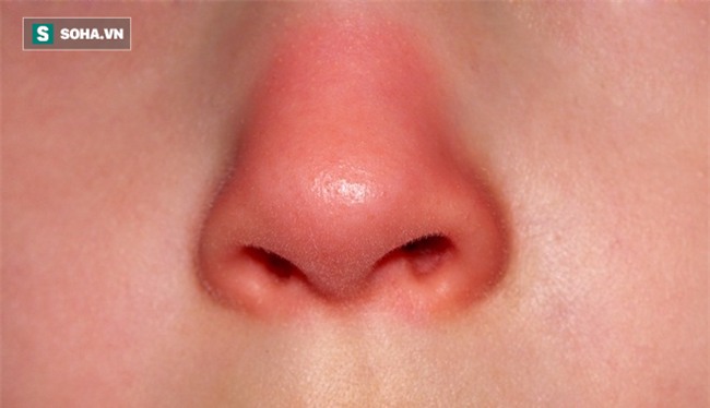 Có 1 trong 5 dấu hiệu này, hãy kiểm tra gan ngay trước khi quá muộn - Ảnh 4.