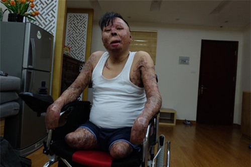 gap chien si duy nhat song sot sau vu may bay roi o hoa lac truoc them nam moi 2017 - 3