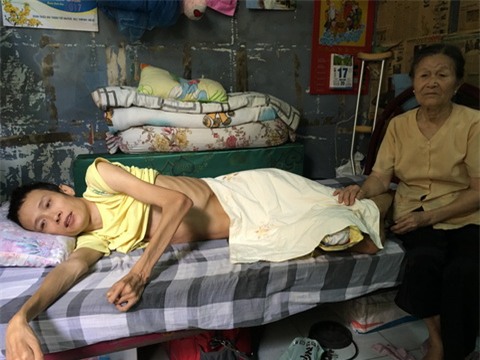 Tình bất ngờ của chàng trai tật nguyền và cô gái xứ Quảng - Ảnh 2.