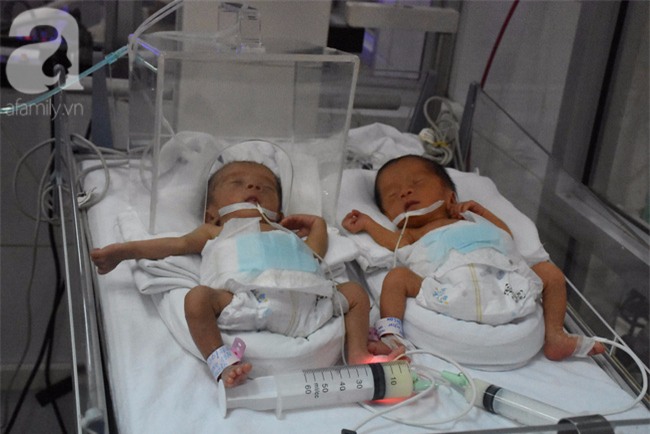 Thời khắc giao thừa của những trẻ chân chỉ bằng ngón tay người lớn, nặng dưới 1kg - Ảnh 2.