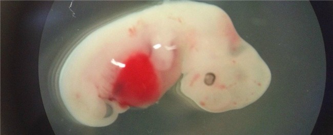 lan dau tien tao thanh cong phoi thai nua nguoi, nua lon hinh anh 1