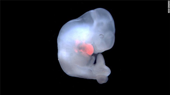 lan dau tien tao thanh cong phoi thai nua nguoi, nua lon hinh anh 2