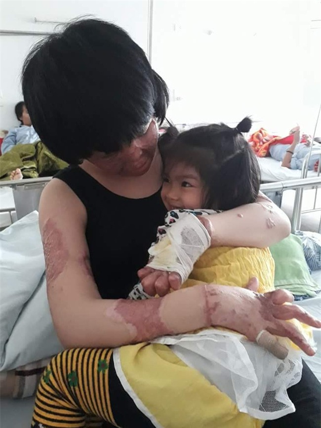 Cô gái bị chồng thiêu sống đúng mùng 2 Tết năm ngoái vẫn đang trên hành trình tìm lại hình hài - Ảnh 9.