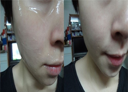 vitamin-e-blogtamsuvn8