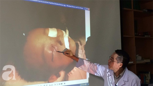 Dượng bóp cò súng săn, đạn trúng vào hốc mắt cháu trai 3 tuổi - Ảnh 1.