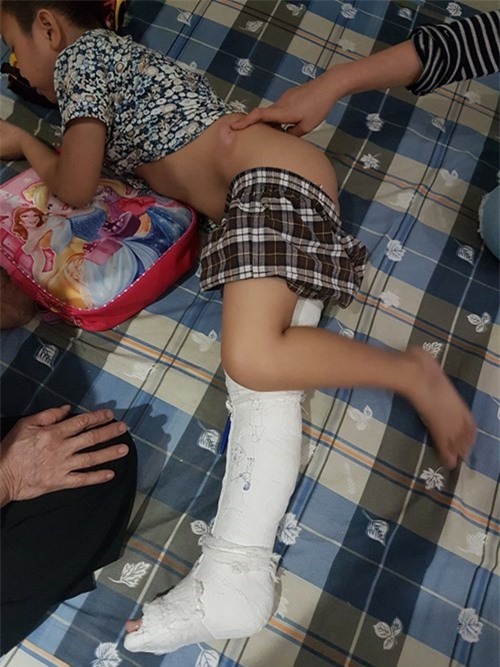 Hoc sinh gay chan tai truong: Cau cuu nhung khong co hoi am hinh anh 1