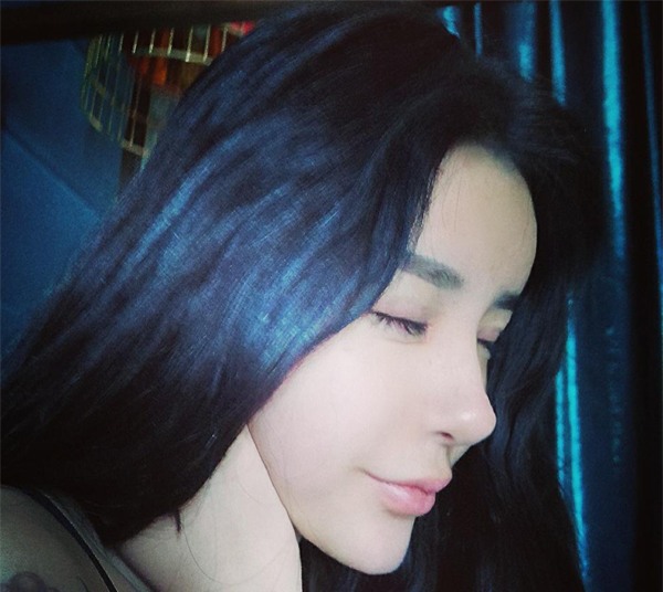 Mỹ nhân mặt rắn từng đập mặt đi xây lại năm ấy giờ ra sao? - Ảnh 6.