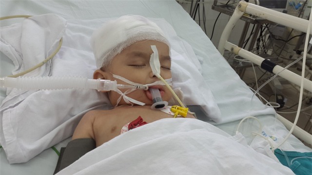 Bé vẫn nằm hôn mê, phải thở máy. Ảnh PT