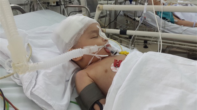 Sớm thiếu tình thương của cha, giờ bé An 22 tháng tuổi đã phải chịu nỗi đau tai nạn hành hạ. Ảnh PT
