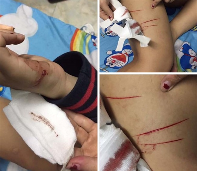 Nu sinh to bi ke bien thai rach dui trong dem hinh anh 1