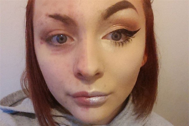 Chẳng ai ngờ rằng, khuôn mặt bị vảy nến sau make-up của cô gái này lại xinh đẹp như vậy - Ảnh 1.
