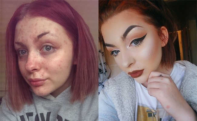 Chẳng ai ngờ rằng, khuôn mặt bị vảy nến sau make-up của cô gái này lại xinh đẹp như vậy - Ảnh 3.