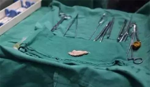 Sản phụ bị bác sĩ bỏ quên băng gạc trong người hơn 70 ngày, bệnh viện đền 100.000 đồng - Ảnh 3.