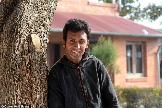 Chàng trai từng tuyệt vọng vì bị mồm dính ngực sau hỏa hoạn năm nào giờ đã có cuộc sống mới đầy hạnh phúc - Ảnh 2.