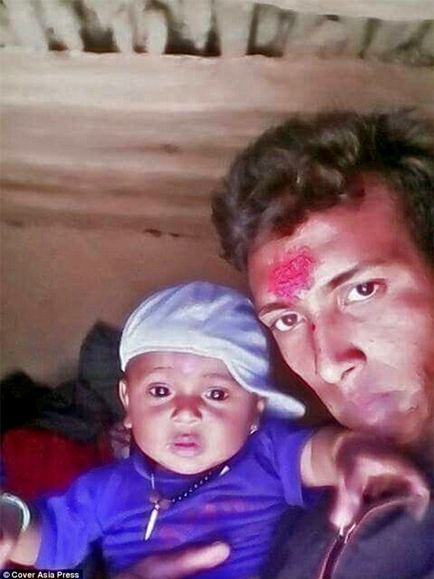 Chàng trai từng tuyệt vọng vì bị mồm dính ngực sau hỏa hoạn năm nào giờ đã có cuộc sống mới đầy hạnh phúc - Ảnh 5.