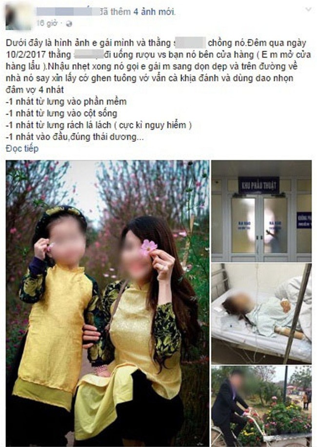 Hà Nội: Người vợ xinh đẹp bị chồng đâm trọng thương phải nhập viện cấp cứu trong đêm - Ảnh 1.