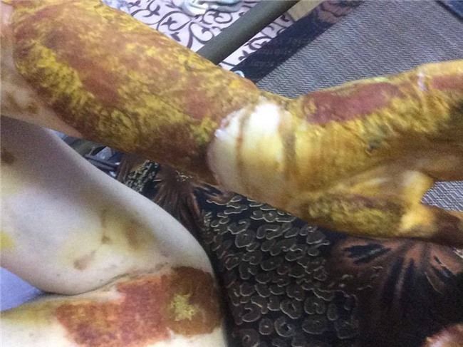 Chủ tịch Nguyễn Đức Chung yêu cầu kiểm điểm việc chậm xử lý vụ nữ sinh bỏng