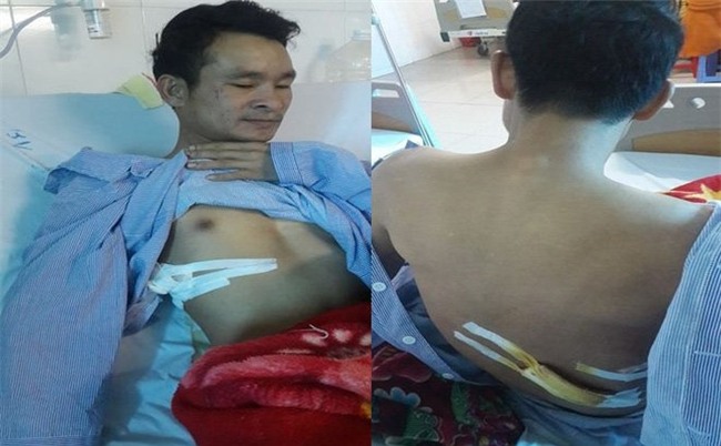 Lời kể nhân chứng vụ thanh niên cứu người lại bị đâm