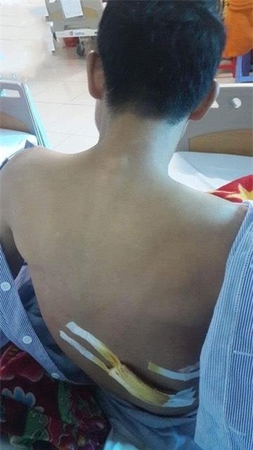 Lời kể nhân chứng vụ thanh niên cứu người lại bị đâm